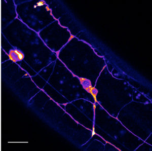Neurons under tension - genetically encoded force reporter